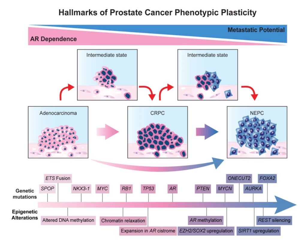 Hallmarks of Prostate Cancer Phenotypic Plasticity